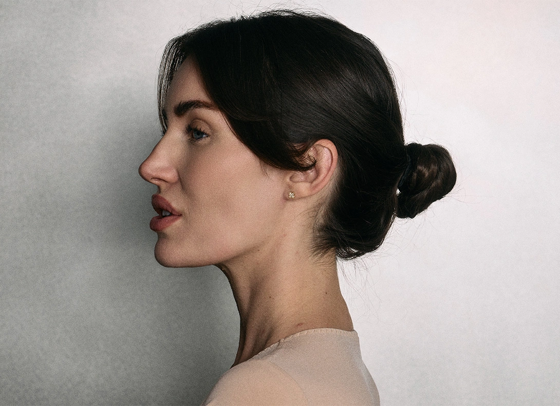 Woman with dark hair in low bun hairstyle shown in side profile against white background. - Ear pinning and ear reshaping in Montreal, QC