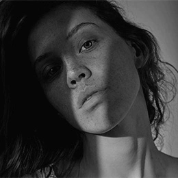 Woman with natural beauty shown in black and white portrait before rhinoplasty revision consultation - teenage rhinoplasty in Montreal, QC