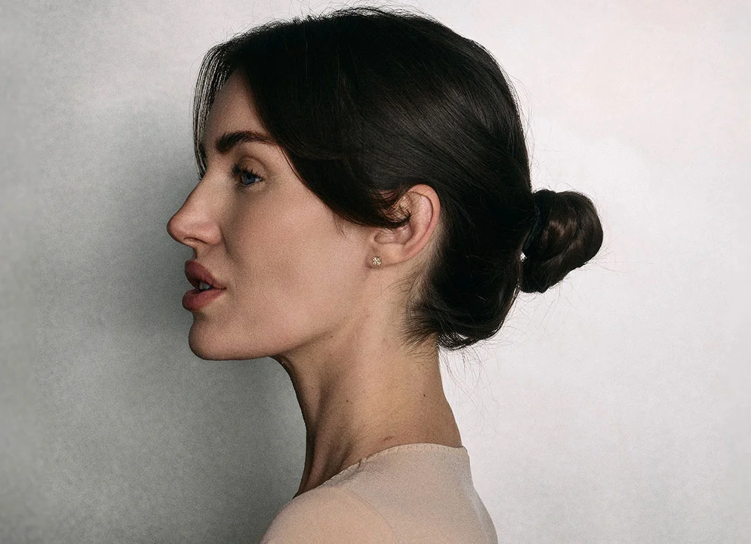 Woman in profile showing natural ear position before otoplasty ear pinning surgery procedure - Ear pinning in Montreal, QC