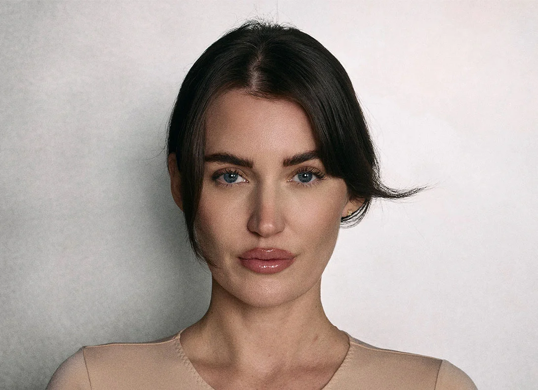 Woman with center-parted dark hair and natural makeup showing forehead and hairline before cosmetic procedure - hairline lowering in Montreal, QC