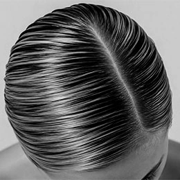 Slicked back men's hairstyle showing hair texture and scalp visibility indicating early male pattern baldness - PRP in Montreal, QC