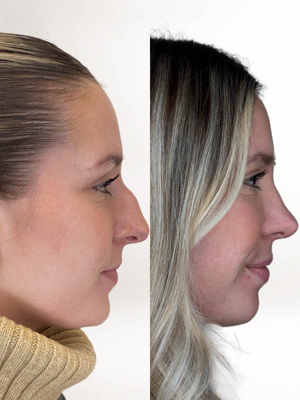 1_0009_rhibo-ap-5month (7).JPG