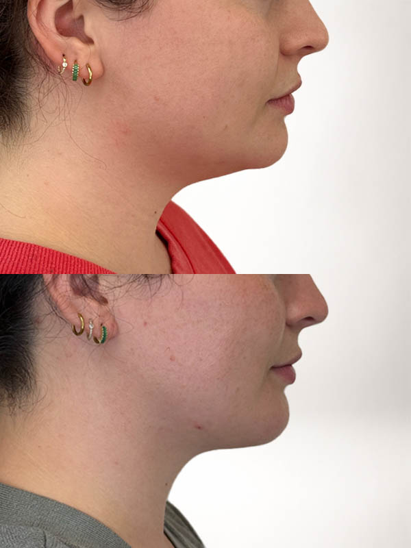 partial_0008_chinneckGG3month (6).JPG