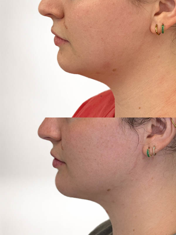 partial_0009_chinneckGG3month (11).JPG