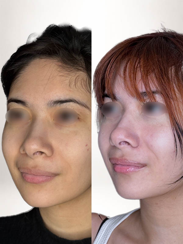partial_0024_rhinoDA (6).JPG